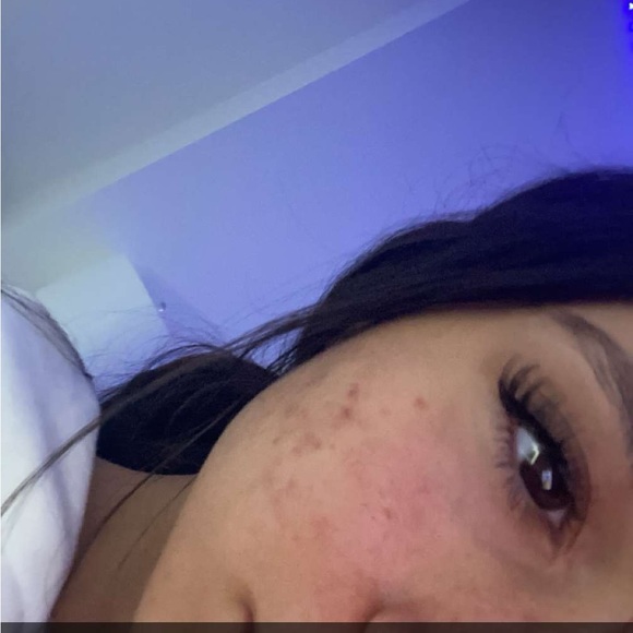 zoechustulakis